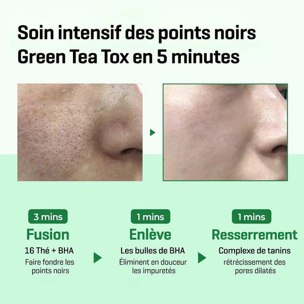 BYE BYE BLACKHEAD 30 DAYS MIRACLE GREEN TEA TOX BUBBLE CLEANSER 120G Some By Mi
