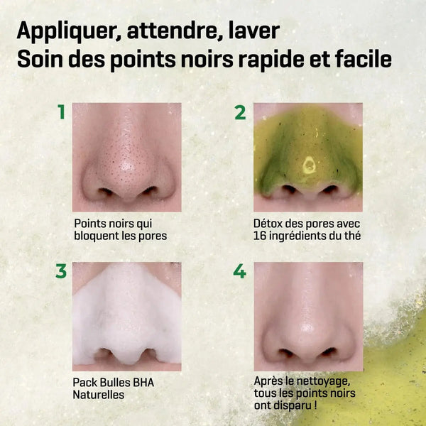 BYE BYE BLACKHEAD 30 DAYS MIRACLE GREEN TEA TOX BUBBLE CLEANSER 120G Some By Mi