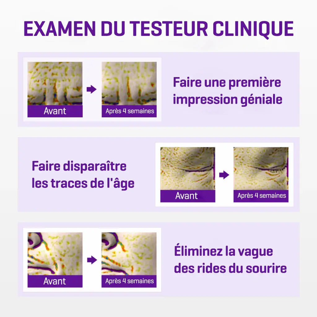 RETINOL INTENSE ADVANCED TRIPLE ACTION EYE CREAM 30ML Some By Mi