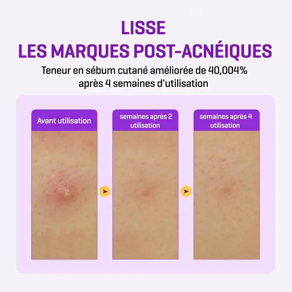 RETINOL INTENSE REACTIVATING SERUM 30ml Some By Mi