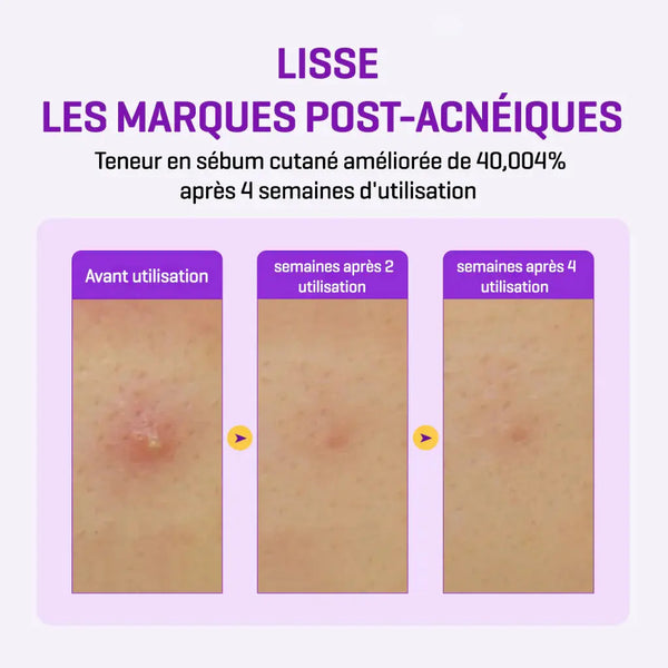 RETINOL INTENSE REACTIVATING SERUM 30ml Some By Mi