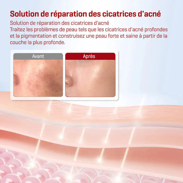 SNAIL TRUECICA MIRACLE REPAIR TONER 150ML Some By Mi